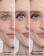 Blemish Defeat'r BHA Spot-Targeting Gel - Image 8
