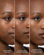 Blemish Defeat'r BHA Spot-Targeting Gel - Image 9