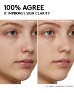 Cherry Dub Pore Purify'r Gel Cleanser with Niacinamide + Aloe Juice - Image 5