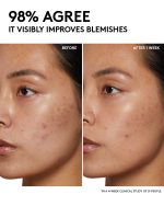 Cherry Dub Pore Purify'r Gel Cleanser with Niacinamide + Aloe Juice - Image 6