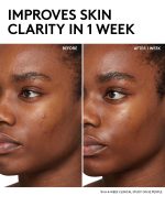 Cherry Dub BHA Toner with Salicylic Acid + Aloe Juice - Image 2